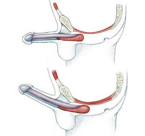 Pubococcygeus penis without training the muscle and after