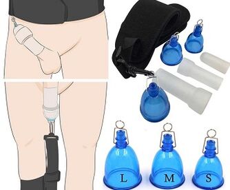 The impact of pump use to increase the member