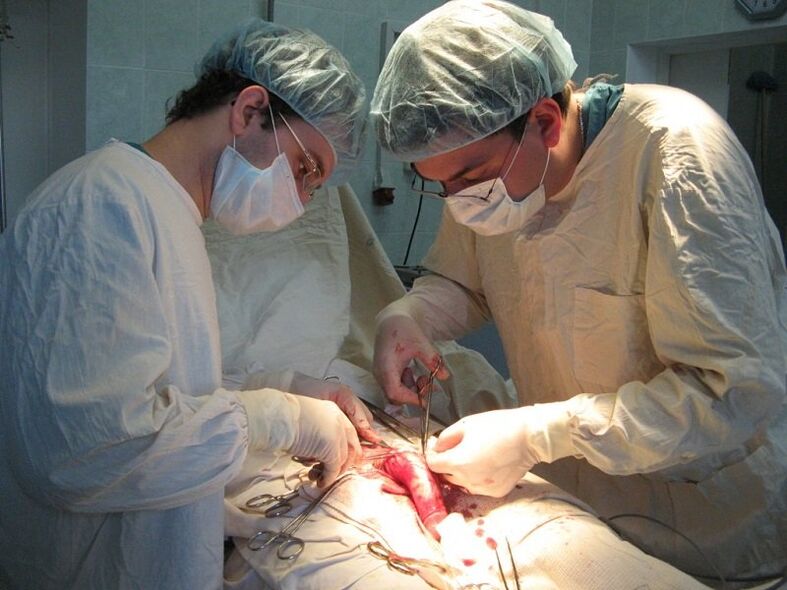 Conducting a conjunctotomy – surgery to increase the length of the penis